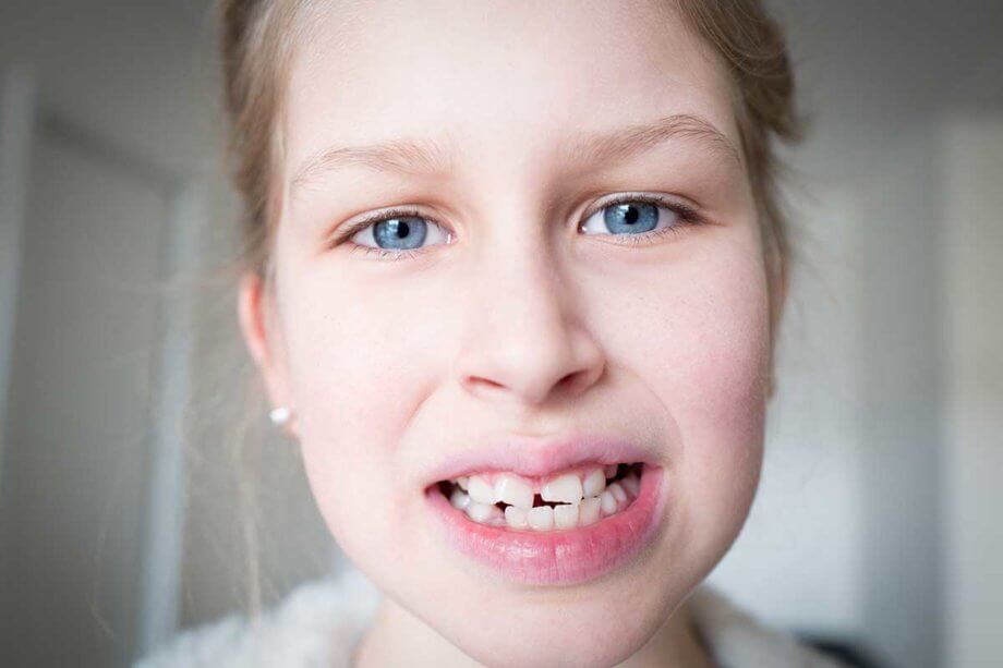 young girl with crooked teeth