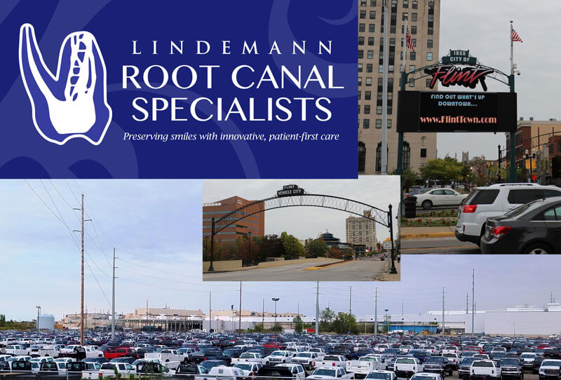 Root Canals in Flint MI